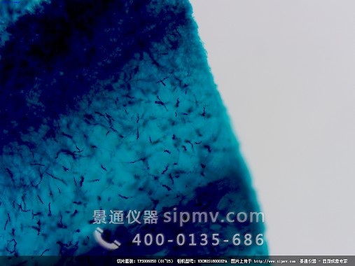 顯微鏡下的青霉菌