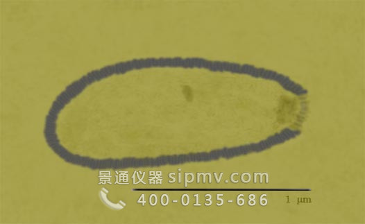 闊口罐病毒
